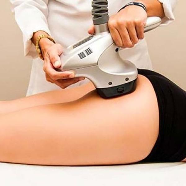 VelaShape III